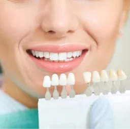 Dental Veneers