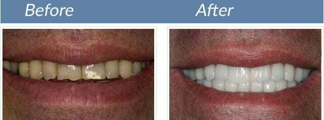Smile transformation 7