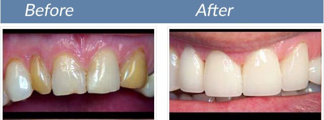 Smile transformation 9